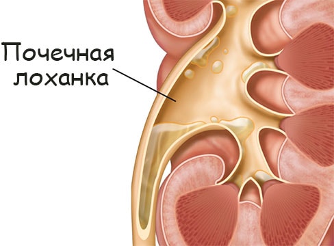 Кракен даркент